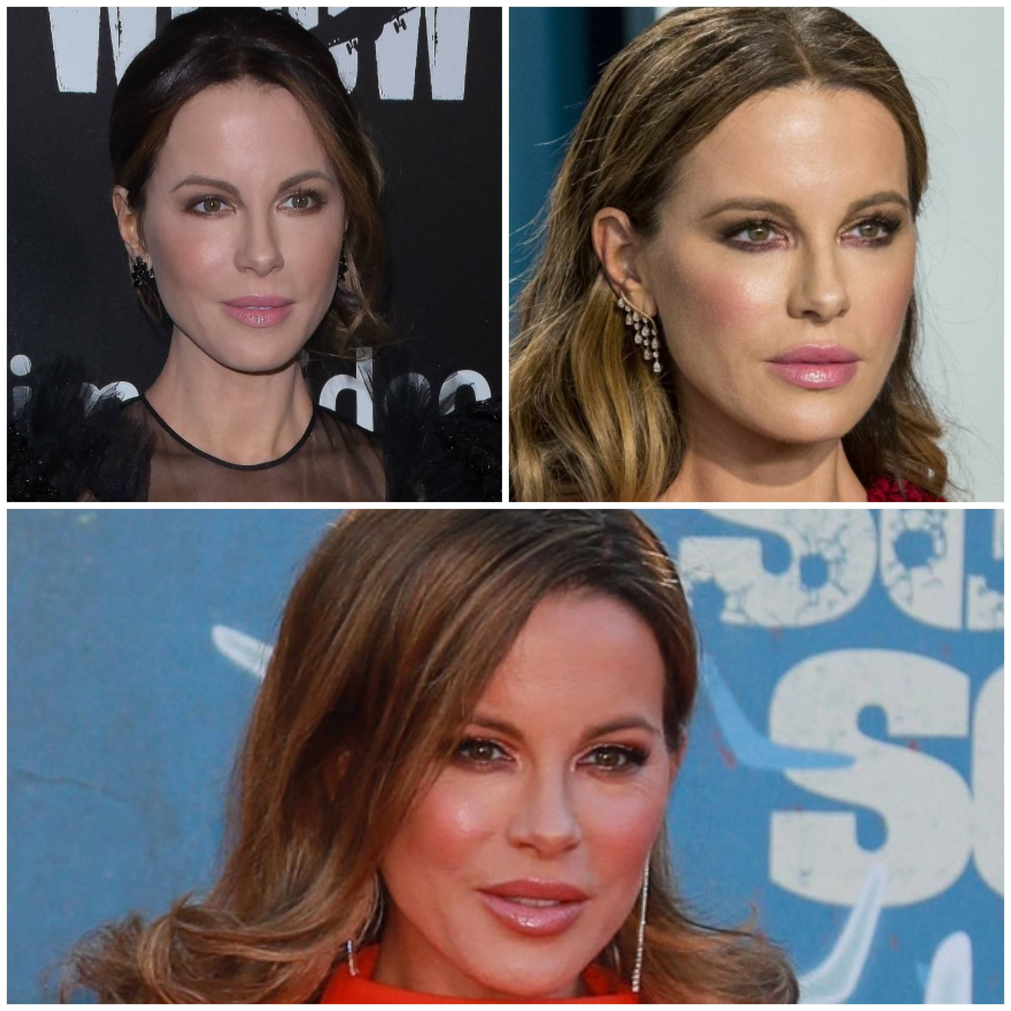 Kate Beckinsale Nose Job Before After