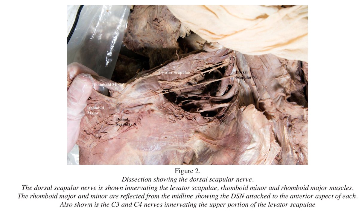 ɹǝʇlnoԀ pıʌɐᗡ 🚴🏻 🇺🇸 🇦🇺 🇬🇧 tweet media