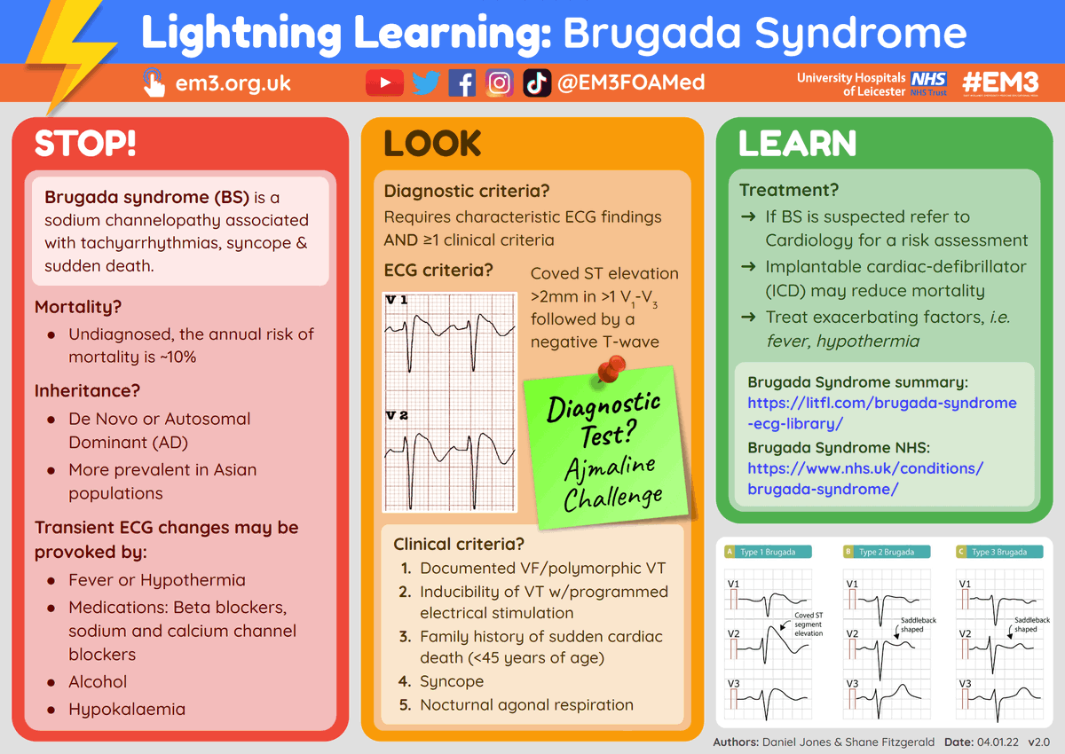 EM3FOAMed's tweet photo. For more information on Brugada Syndrome, you might want to check out our #LightningLearning factsheet on the topic โก