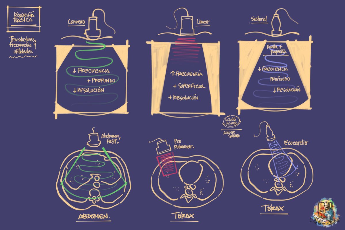 Ecografia basica, transductores, frecuencias y utilidades. Ultrarresumen.

#foamed #foam #meded #enarm #apuntes #medicina #urgencias #atencionprimaria #mfyc #enfermera #mir24 #eir24 #usmle #medicine #nursing #ekg #medicalnotes #notes #apuntes #ipad #procreate