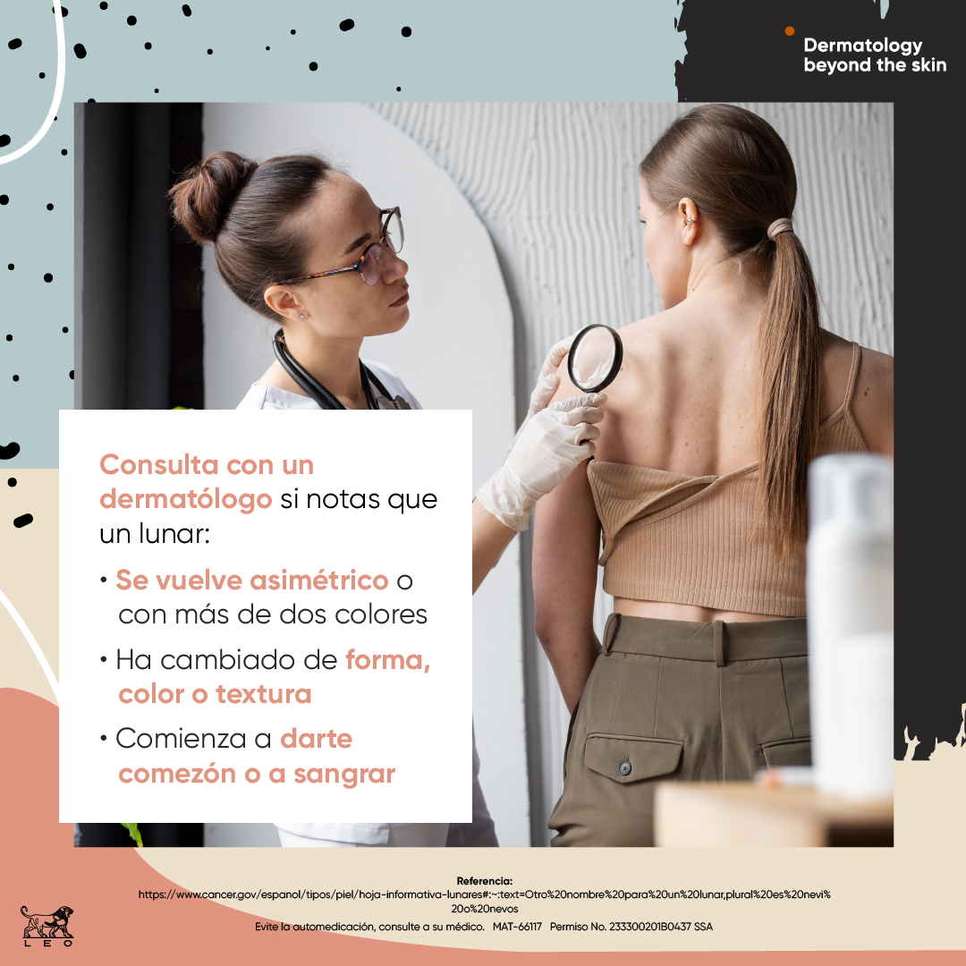 LeoPharmaMX's tweet photo. ¿Podrías identificar cuándo un lunar es normal y cuándo hay que acudir al médico? Aquí te lo explicamos para que cuides tu piel.
#lunares #leopharma #leotips https://t.co/2JgyI5HJxj