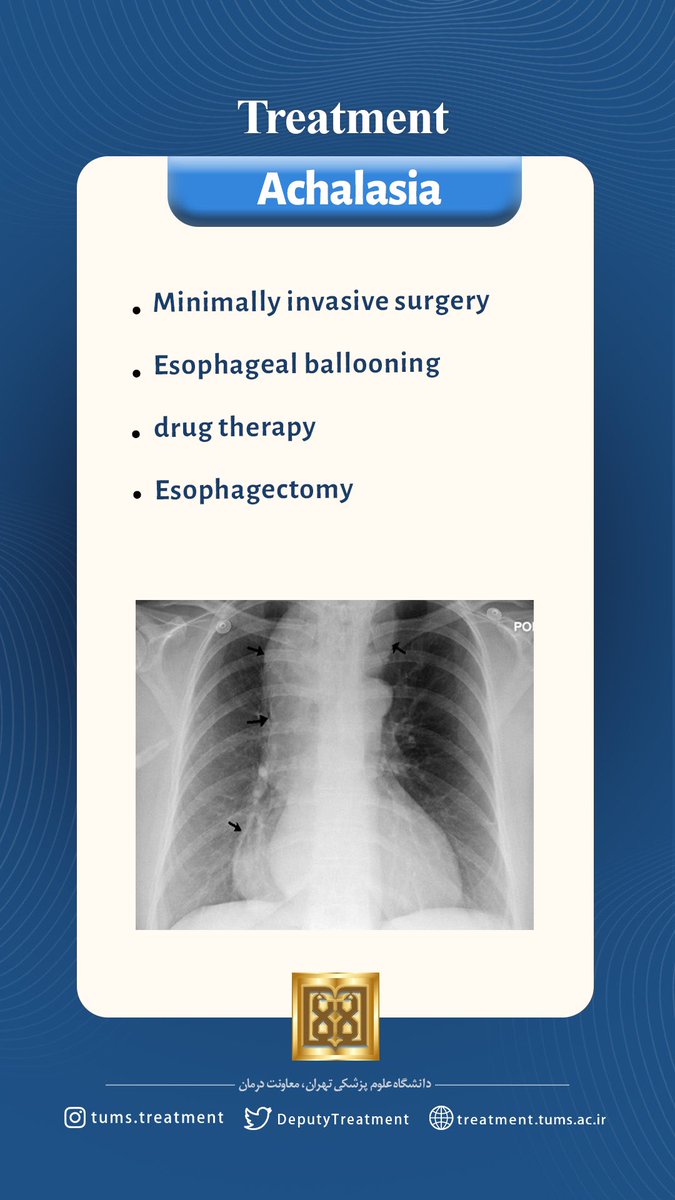 #achalasia #disease #treatment