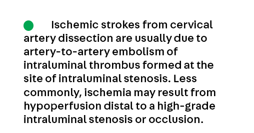 Bonus Key Point 2 from the article Cervical Artery Dissection by Dr. Setareh Salehi Omran (@SetarehOmranMD), which is available to subscribers at continpub.com/CervArtDis #neurology #MedEd #NeuroTwitter