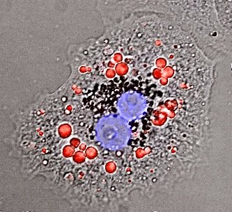 This is how #lipid droplets look in our #cells 
#Microscopy