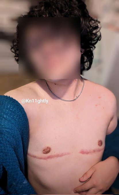 Who wants to have some fun 😉🥴 #sexy #trans #ftm #hot #queer https://t.co/sWEwMtBcrX<a href="/tag/sexy"class="tags">#sexy</a><a href="/tag/trans"class="tags">#trans</a><a href="/tag/ftm"class="tags">#ftm</a><a href="/tag/hot"class="tags"><span>#hot</span></a><a href="/tag/queer"class="tags"><span>#queer</span></a>