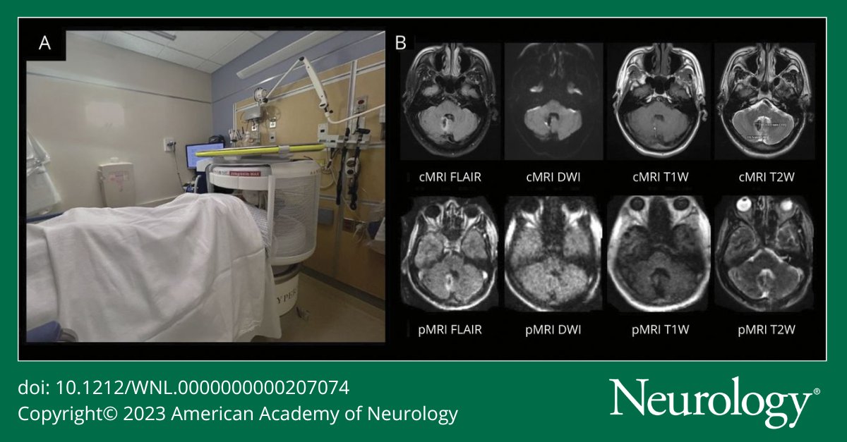 Read about current applications for low-field portable MRI, including in acute and critical care settings, barriers to broad implementation, and future opportunities in the latest Future of Neurology & Technology article: bit.ly/45zJRHs

#NeurologyRF #NeuroTwitter