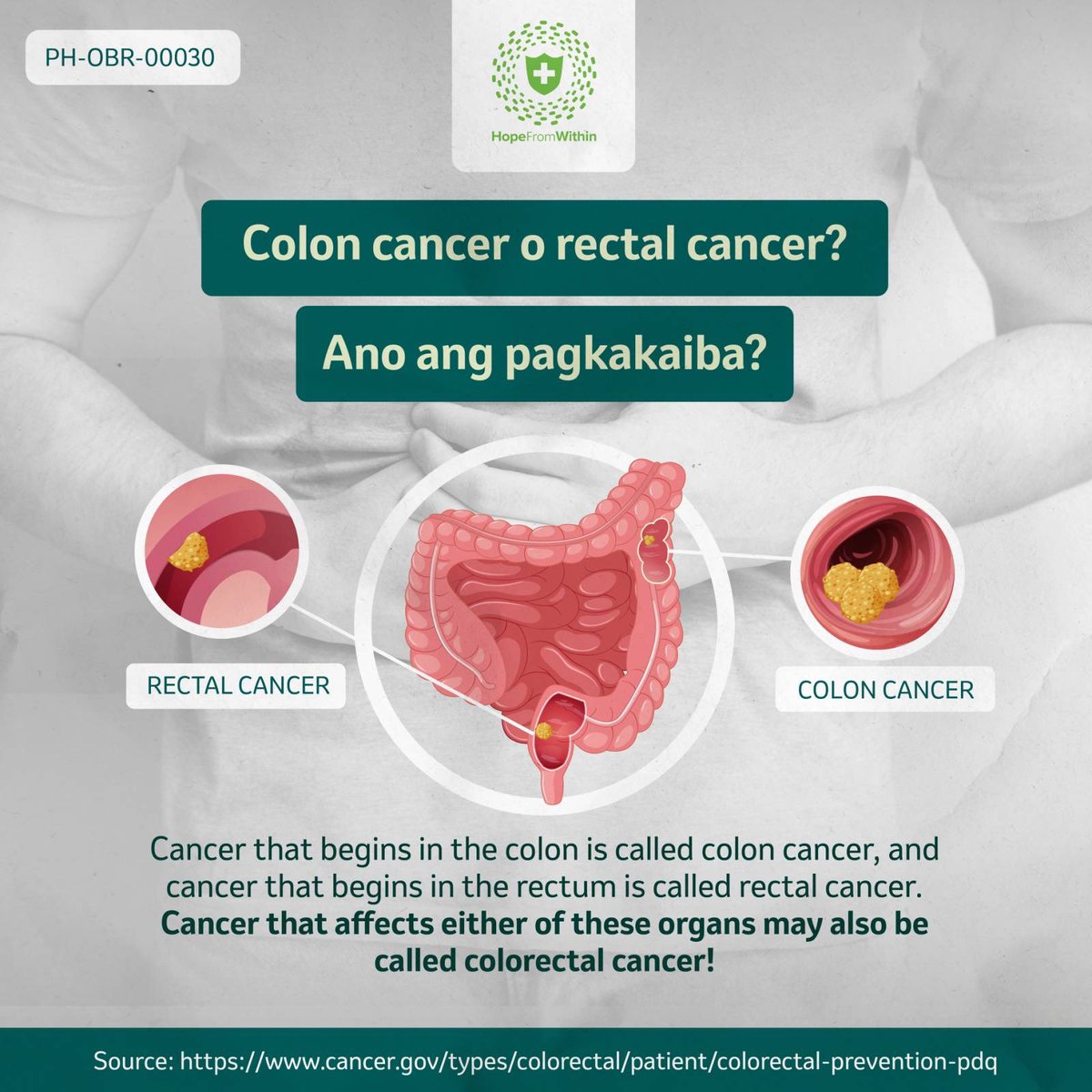 Colon cancer? Rectal cancer? Colorectal cancer?

Kahit ano pa ‘yan, ang mahalaga, may paraan para malaman ang risk natin sa colorectal cancer at kung paano ito mapapababa.