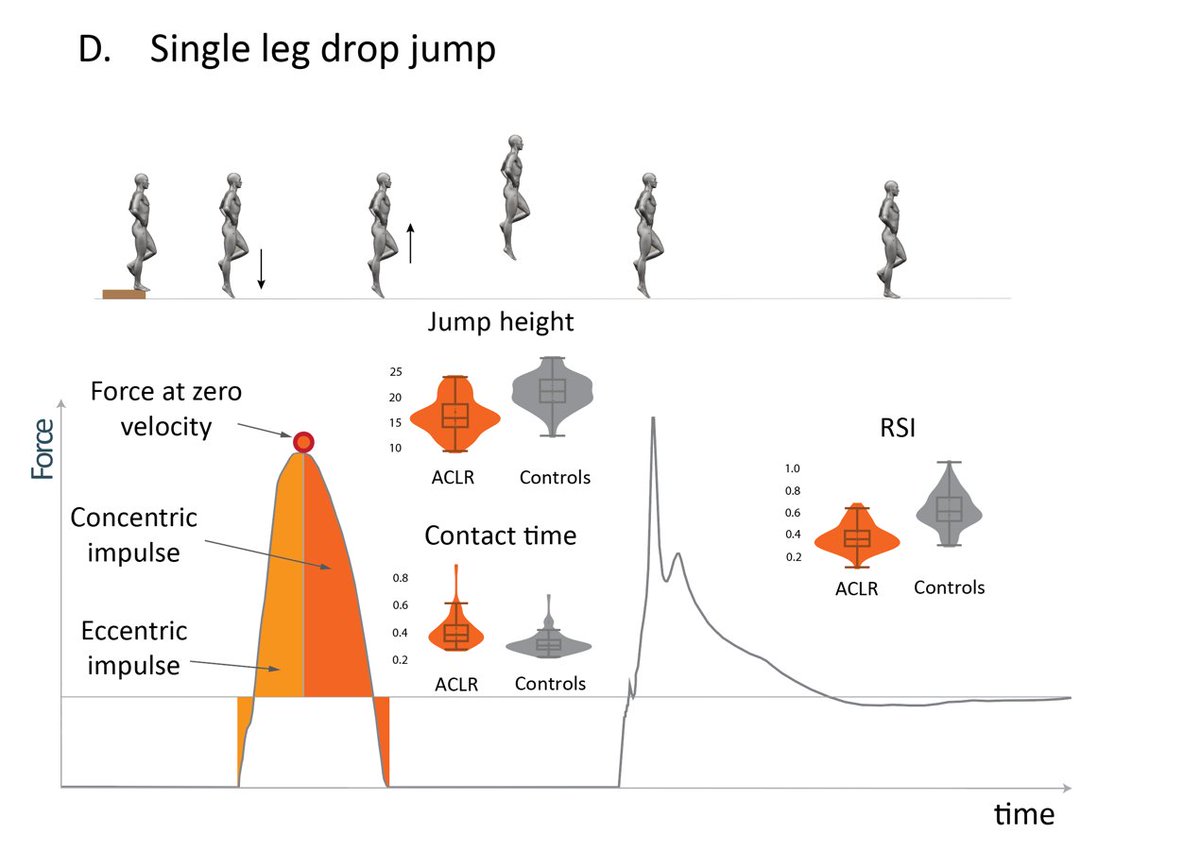 Vertical jump testing at the time to #RTS after #ACLR.
Which tests?
How?
Which metrics?
Normative data

bjsm.bmj.com/content/early/…  

Check this thread! 👇