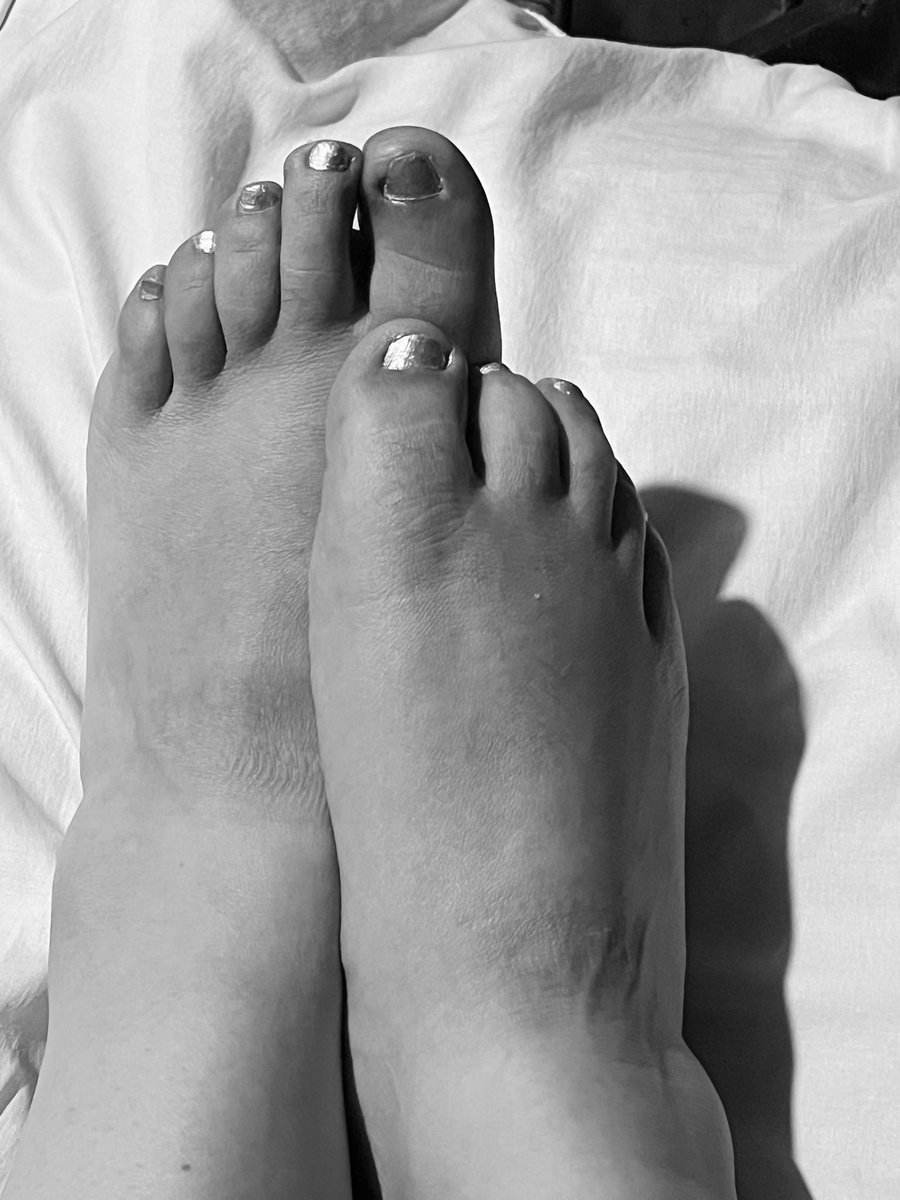 littleApple2OF's tweet photo. Buenas noches

https://t.co/RYqh0cdlzo

#feets #feet_lover #feet_pic #onlyfans https://t.co/Kbw7zWJBA8
