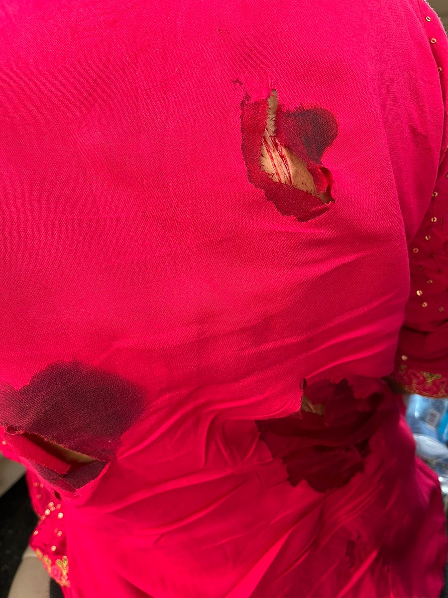 azizkavish's tweet photo. क्या तमाशा है, हाथ में हथियार लेकर एक गुंडा लड़की पर हमला करता है, लोग चिल्लाते हैं वीडियो बनाओ...गुंडा लड़की पर वार करता है और धीरे-धीरे चला जाता है
गाजियाबाद में ससुराल पहुंची लड़की को एक गुंडे ने बलकटी से काटकर किया घायल.. https://t.co/kmnV0FA5Bh