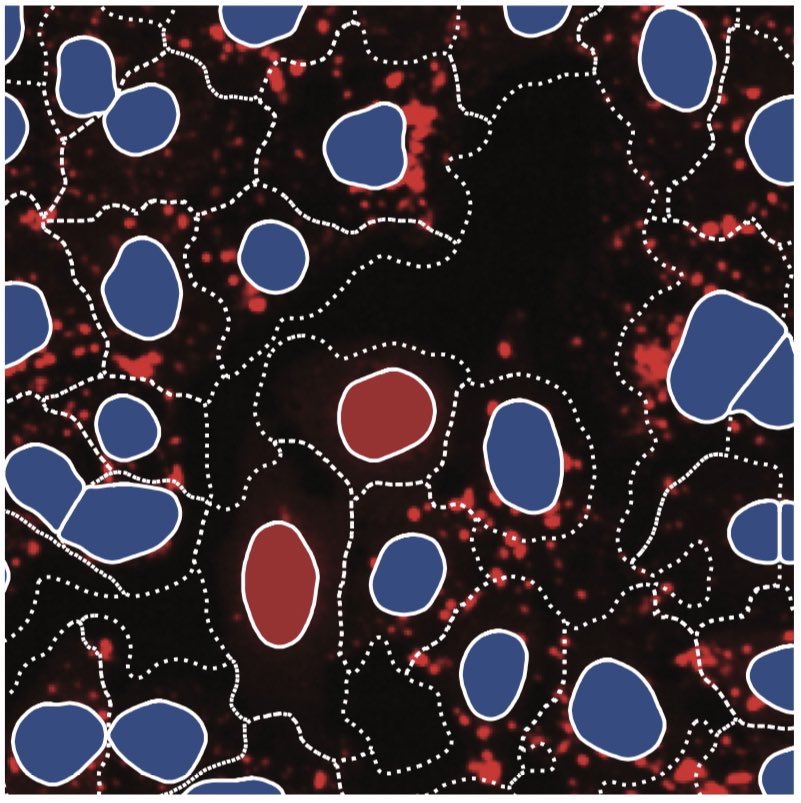 Niklas Schmacke (@niklas_a_s) on Twitter photo Fresh on bioRxiv: @sophiaMaedler and I developed ✨SPARCS✨, a technology for microscopy-based genome-wide genetic screens in human cells🔬🧬
biorxiv.org/content/10.110…
This work was enabled by the amazing collaborative environment created by <a href="/hornung_lab/">HornungLab</a> and <a href="/labs_mann/">Matthias Mann Lab</a>.
🧵👇 Fresh on bioRxiv: @sophiaMaedler and I developed ✨SPARCS✨, a technology for microscopy-based genome-wide genetic screens in human cells🔬🧬
biorxiv.org/content/10.110…
This work was enabled by the amazing collaborative environment created by <a href="/hornung_lab/">HornungLab</a> and <a href="/labs_mann/">Matthias Mann Lab</a>.
🧵👇