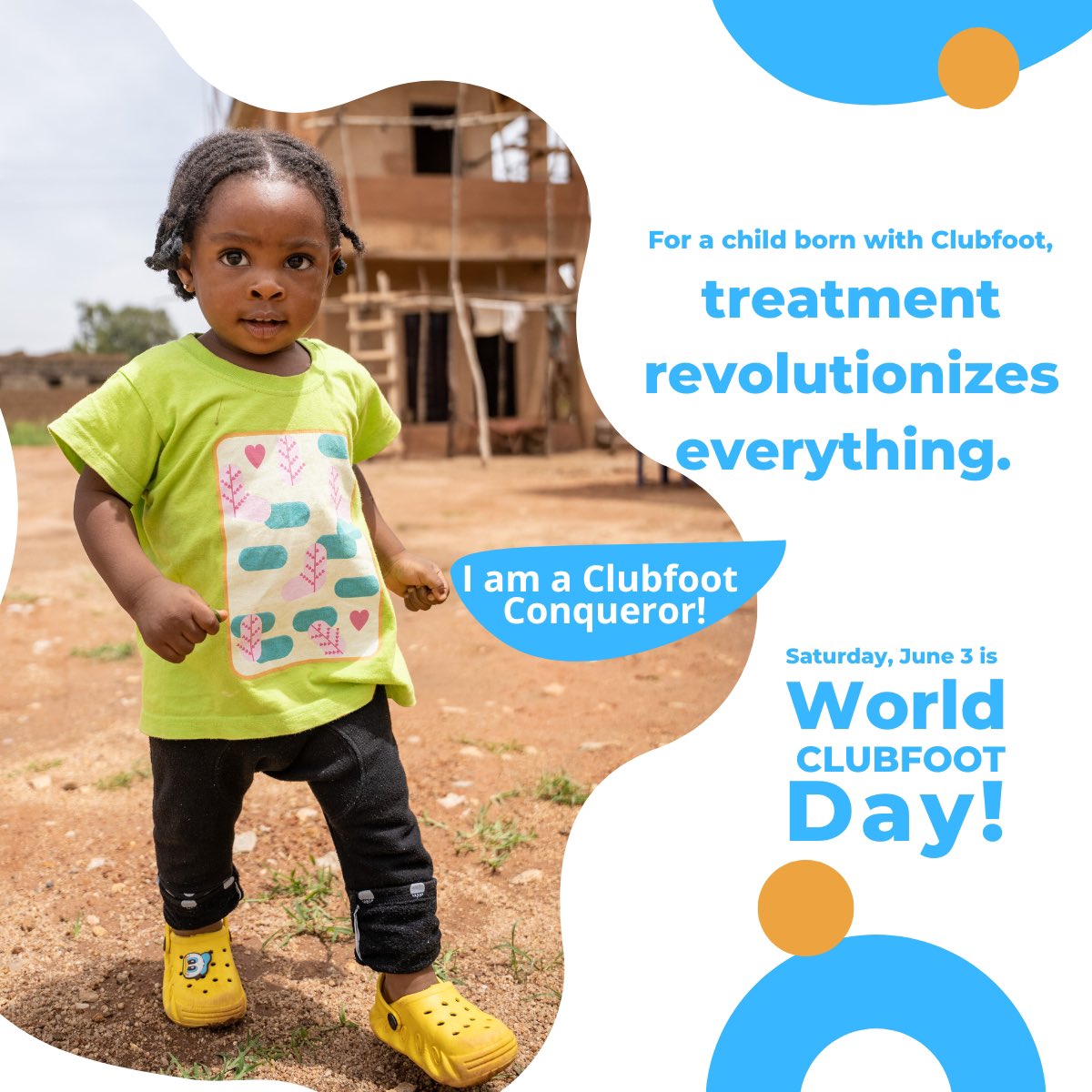 Join HANDS Nigeria and MiracleFeet in our mission to transform lives and break barriers for children with #clubfoot in Nigeria. June 3 is #WorldClubfootDay2023.

#ManyFeetMovement #WCD2023 #handsnigeria #MiracleFeet
#PonsetiMethod #ClubfootAwareness
#LeaveNoOneBehind #WCD