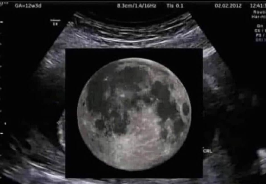 Look i found yours mother's sonography when she was pregnant