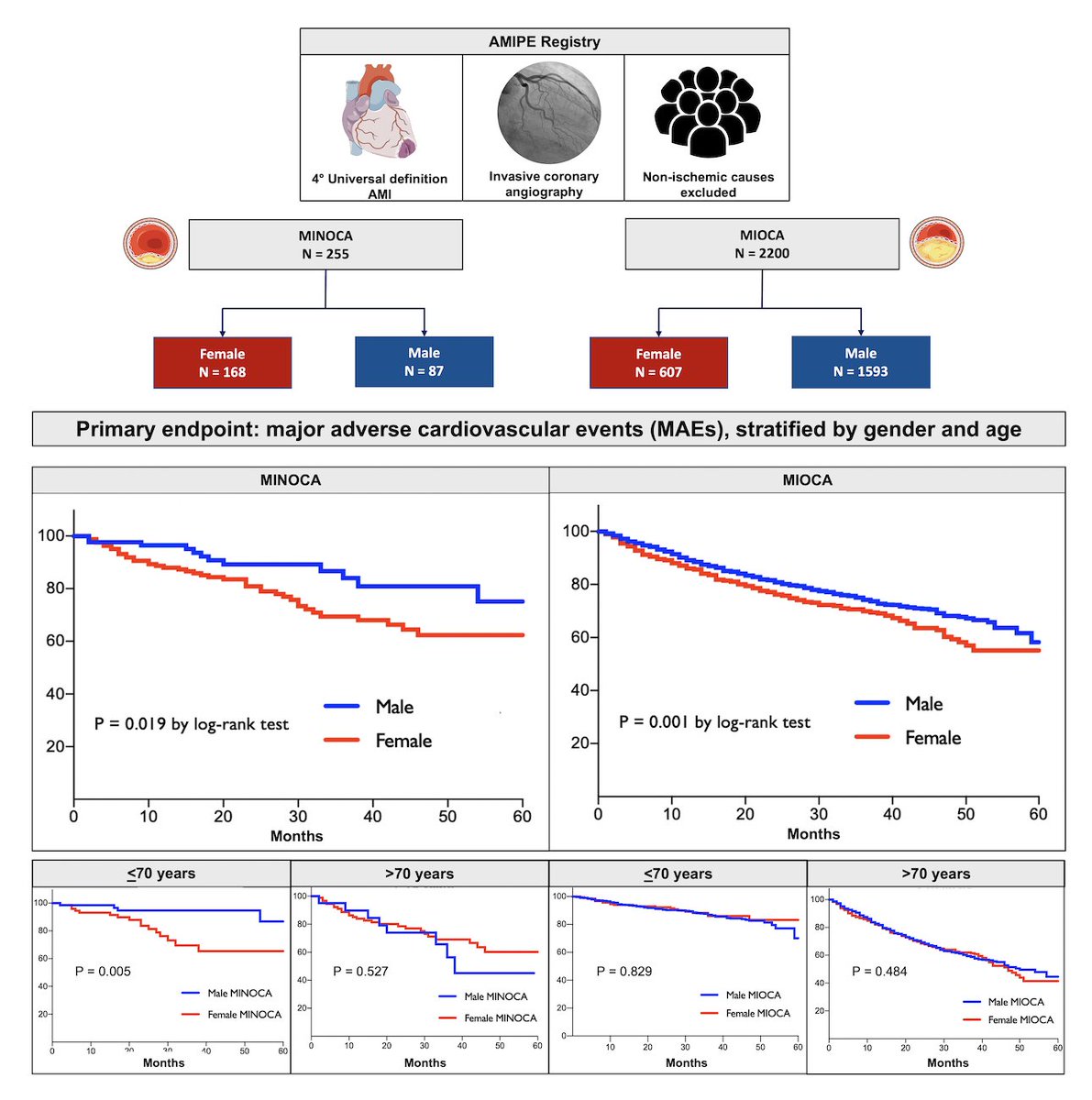 P_Paolisso's tweet photo. New insights into the impact of sex and age on outcomes in #MINOCA:
🎯Females <70y had ⬆️incidence of #MACE compared to male peers, likely due to the different pathophysiology of the ischemic event!
https://t.co/Luo98yD9EJ

@ESC_Journals @PCRonline 
#Cardiology #CardioTwitter https://t.co/efhhAUTvkk
