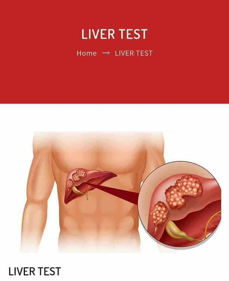 LIVER TEST
For more details, please contact us at
+91- 9810043684
#labgeetacolony #surepathlab #delhi #noidacity #delhi #noida #ildprofile #labtest #meerut #jaipur #Lucknow #thyroid #rheumatoid #liver
#thyroid #bloodtest #Diagnostic #diabetes