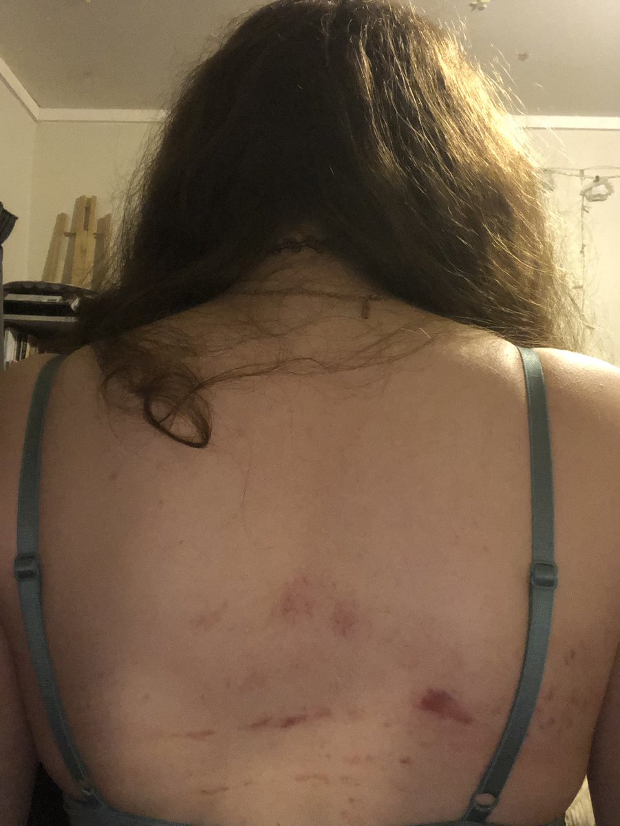 TheJadeJudith's tweet photo. One of these days I’m going to get beat up badly like Daniel Bryan

(I’m okay I promise, I just ran the ring ropes super hard during my training) https://t.co/HPL6zDEdcK