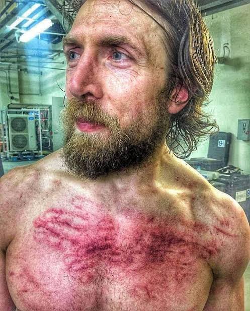 One of these days I’m going to get beat up badly like Daniel Bryan

(I’m okay I promise, I just ran the ring ropes super hard during my training)