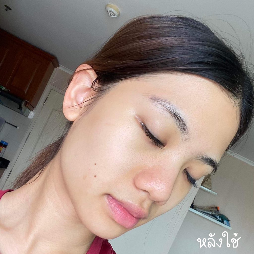 cosmeticsmmd's tweet image. ชั้นค้นพบลูกรักคนเป็นสิวละ !!!! ปังมากก นี่ชอบ #AXISY ทั้งสองตัวเลย น้องเค้าเหมาะกับคนเป็นสิวมากๆ เป็นไลน์สำหรับคนเป็นสิวโดยเฉพาะ ช่วยได้ทั้งเรื่องสิว กับ รอยสิวเลย ปราศจากอันตราย มีทีทรีด้วยย คนเป็นสิวเลิฟแน่เลย เราใช้แล้วสิวยุบไว+หน้าไม่แห้งลอก ชอบมาก 😻 #ของดีบอกต่อ