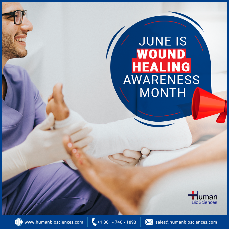 BiosciencesInc's tweet image. Initiated by #ABWM in 2016, #WHAM! is intended to recognize the challenges experienced by individuals whose lives are affected daily by #ChronicWounds.
#HBS will show support by highlighting ways #collagen products can help to promote #healing.
wham-abwmfoundation.org/digital-downlo…
#woundcare