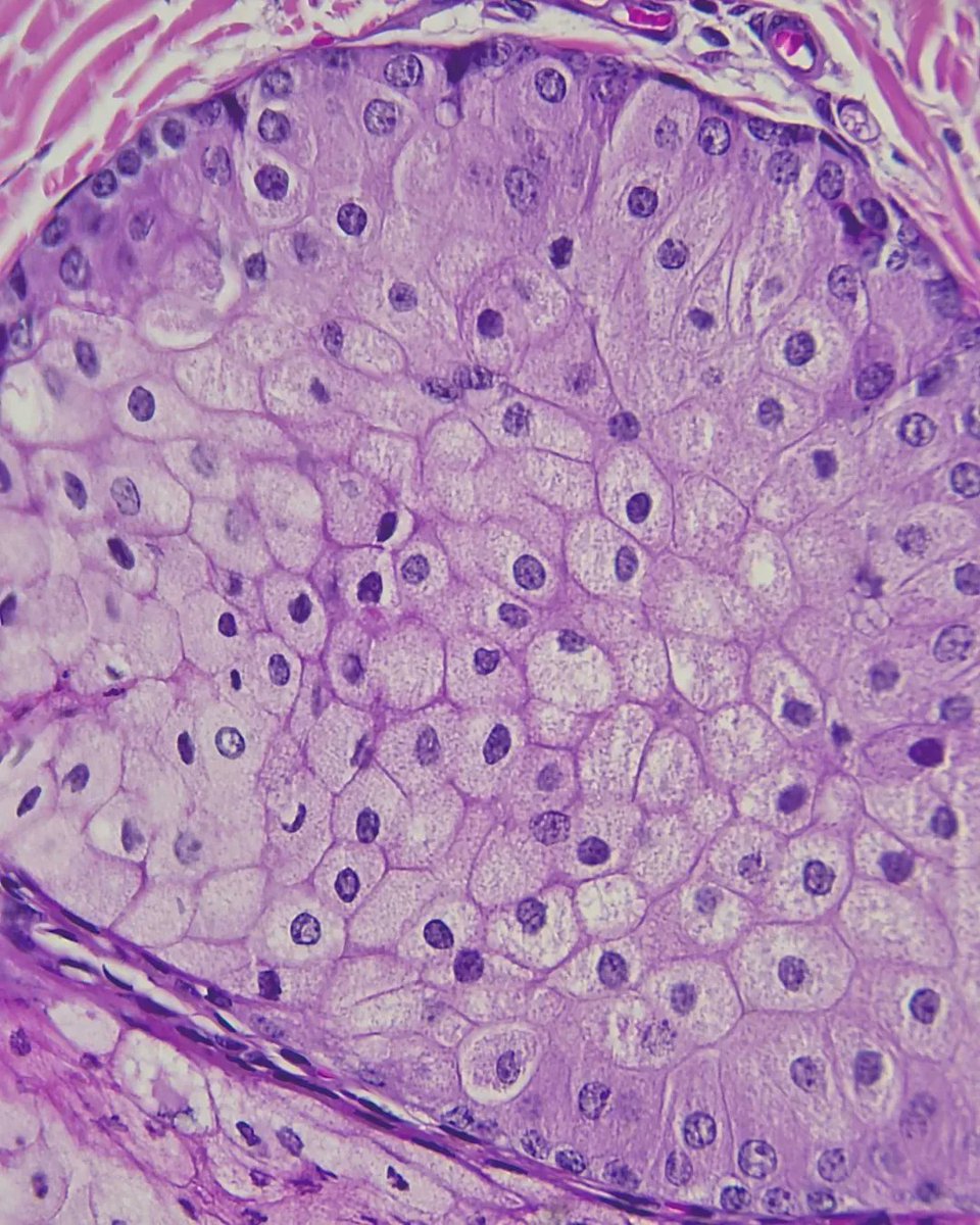 olkazuraw's tweet photo. These are sebaceous glands, that you will find in haired skin.

#digitalpathologyart
#dppart
#pathart
#microscopicphotography 
#microart 
#digitalpathology 
#digitalartwork https://t.co/JOxKpxpm5v