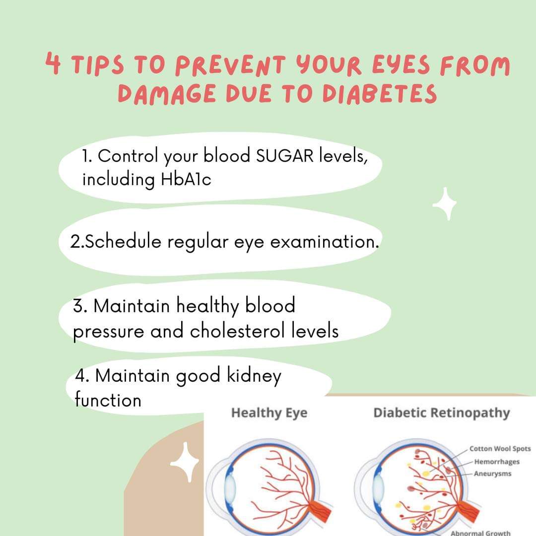 #diabeticretinopathy #diabetesawareness #diabetesmanagement #diabetescontrol #diabetescare #diabeticretinopathyprevention #drkirtirani #ophthalmologist