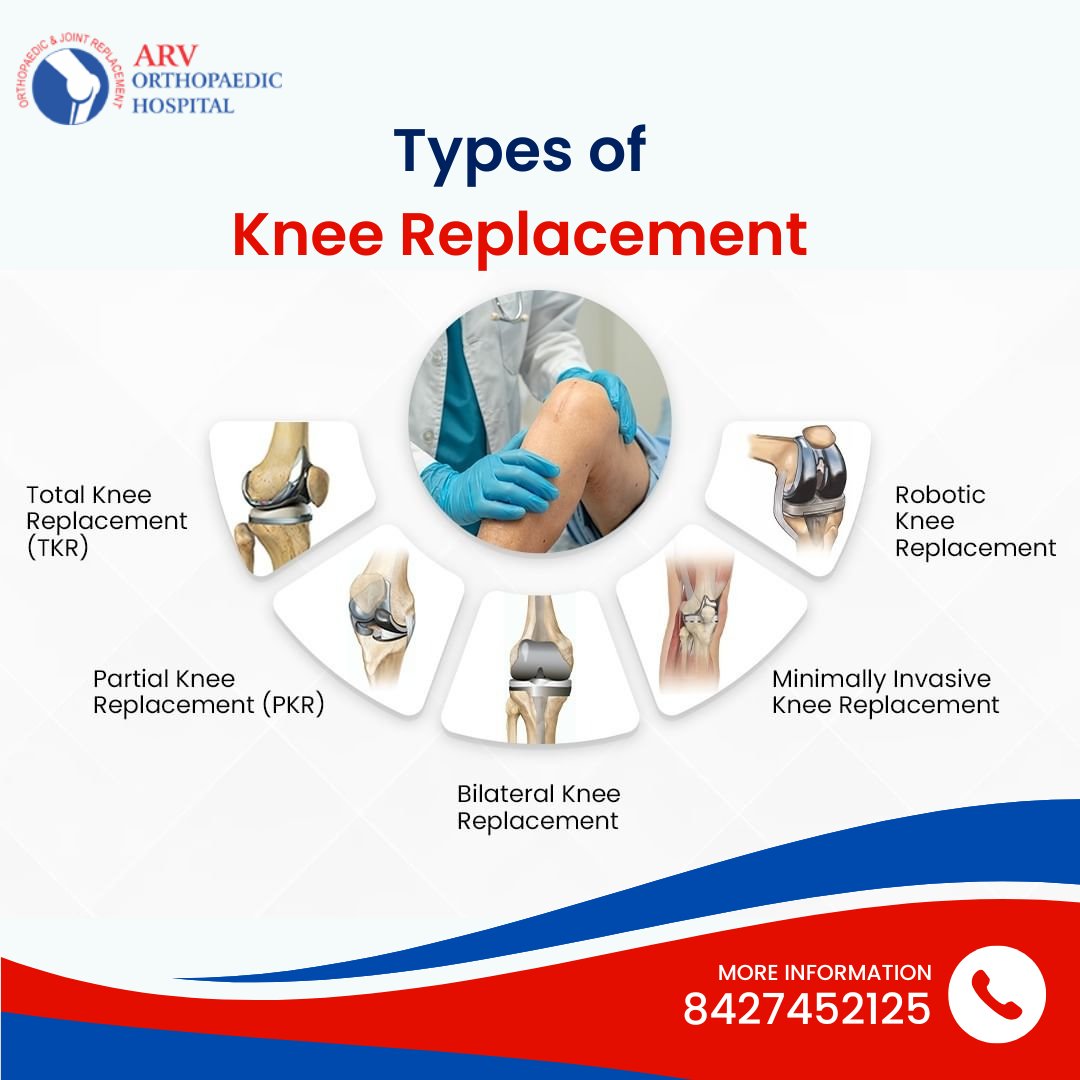 ArvHospital's tweet photo. Pain in your knees can significantly decrease your quality of life. At @ArvHospital, the board-certified physicians thoroughly assess your current knee health to determine the best course of action.

#kneereplacementsurgery #hippain #hipsurgery #health #orthopedicspecialists https://t.co/QL60FT5c0G