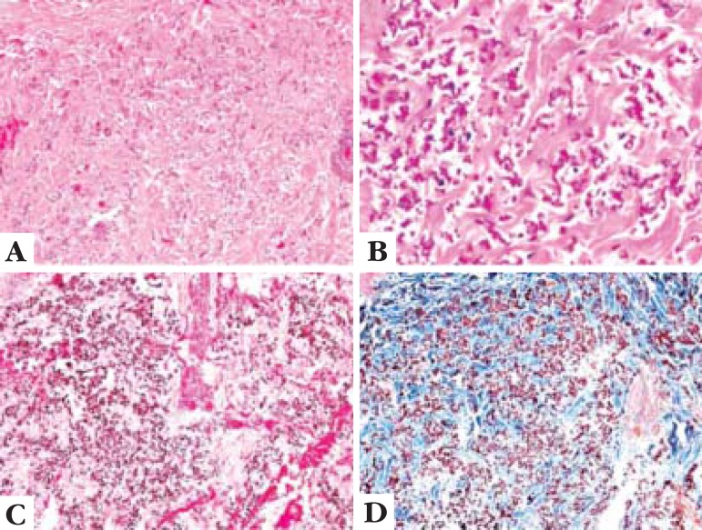 pathobotology's tweet photo. #Pathology #quiz!
1. What tissue is this (#dermpath)?
2. What is in your differential?
3. What is your diagnosis? #WiyD
Case details will be posted as a reply soon! https://t.co/tfOddsVVce