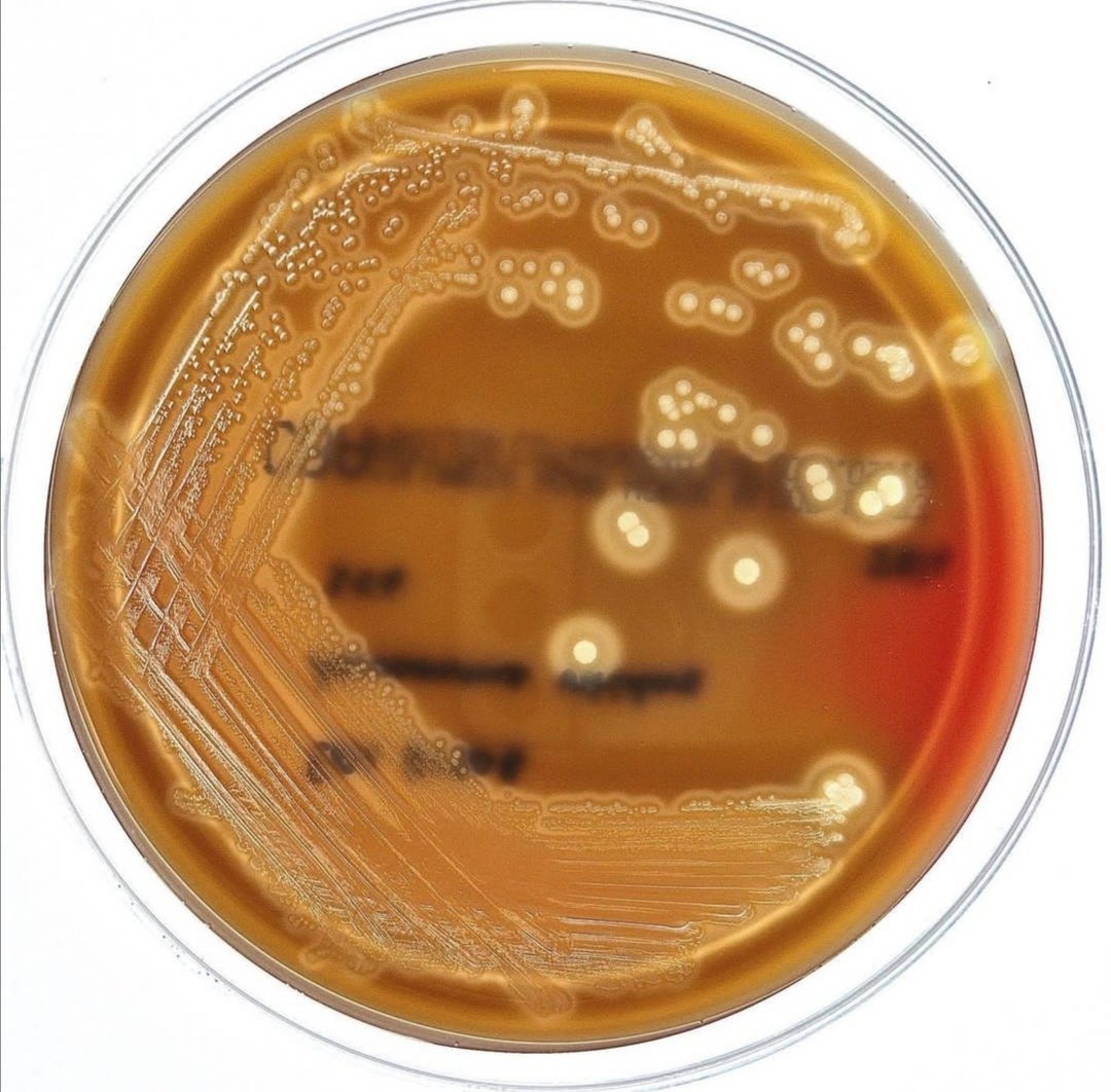 MicrobZoo's tweet photo. 💡Genetic basis of antibiotic resistance in Aerococcus viridans https://t.co/um0FJOaYhN