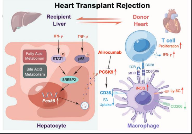 There is immune regulation of macrophages via PCSK9/CD36 in the liver post Heart Transplantation--A potentially novel pathway for treating rejection #Basicscience #Translationalresearch #AHAJournals ahajournals.org/doi/10.1161/CI…