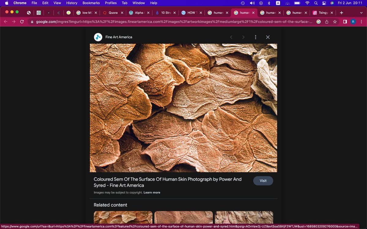 tbstalks's tweet photo. Who told you’re beautiful, this is your skin at 7000x https://t.co/gtqOBPYOrM