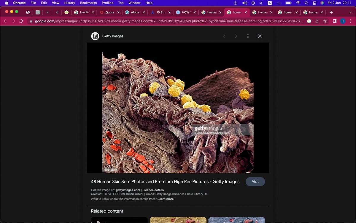 tbstalks's tweet photo. Who told you’re beautiful, this is your skin at 7000x https://t.co/gtqOBPYOrM