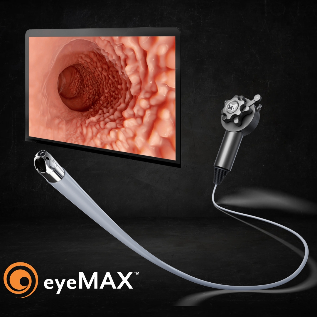 microtechlatam's tweet photo. ¡Descubre los beneficios del #eyeMAX! Canal de trabajo de 2.0mm que permite usar pinzas de biopsia de mayor tamaño. Esto reduce las probabilidades de análisis no concluyentes por parte de patología. #biopsia #tecnología https://t.co/tWCe98TnNF