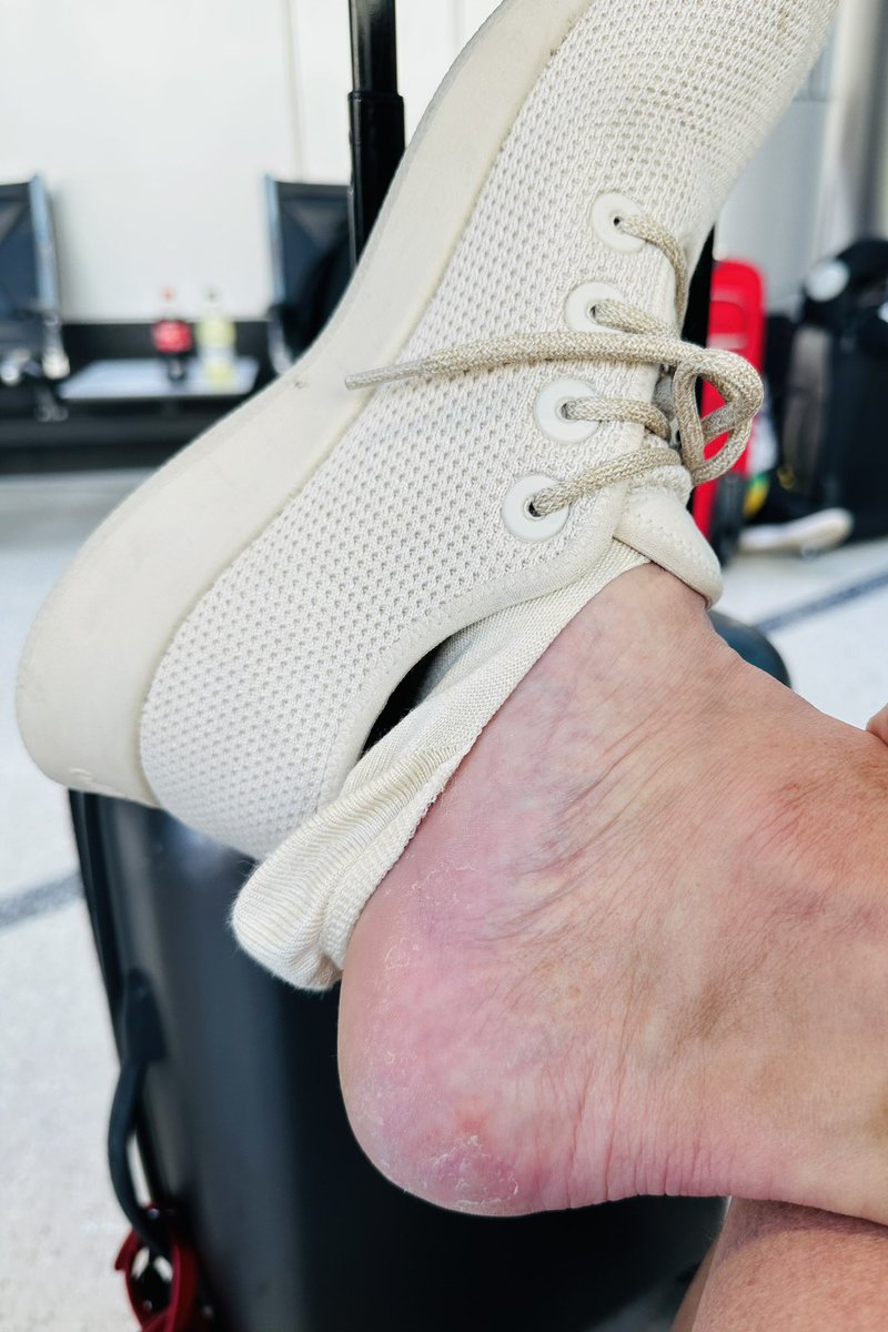 I’ve tried many many brands of No Shows - all terrible - entering this summer season did my research and <a href="/Allbirds/">Allbirds</a> were one of the top pics …epic fail!  Paired them with my #allbird shoes and they are awful - don’t stay on for a minute before they slide off…recommendations?