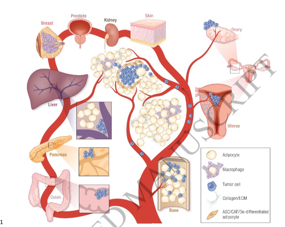 I’m excited to share our new review w/ updates on the relationship between #adipose tissue and #cancer published in Endocrine Reviews. This labor of love was written in collaboration with Philipp Scherer <a href="/UTSWNews/">UTSW Media Relations</a> 
<a href="/TheEndoSociety/">Endocrine Society</a>
 academic.oup.com/edrv/article/d…
