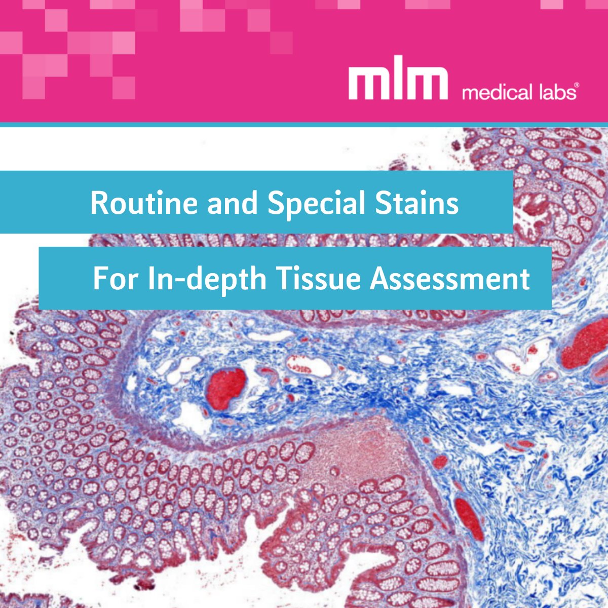 Our #HISTOLOGY lab can process 1000+ H&amp;E stains per day with precision and accuracy to keep your research projects in motion. Learn how our advanced capabilities can bridge the gap between #preclinical findings and clinical applications >> hubs.ly/Q01S5g400