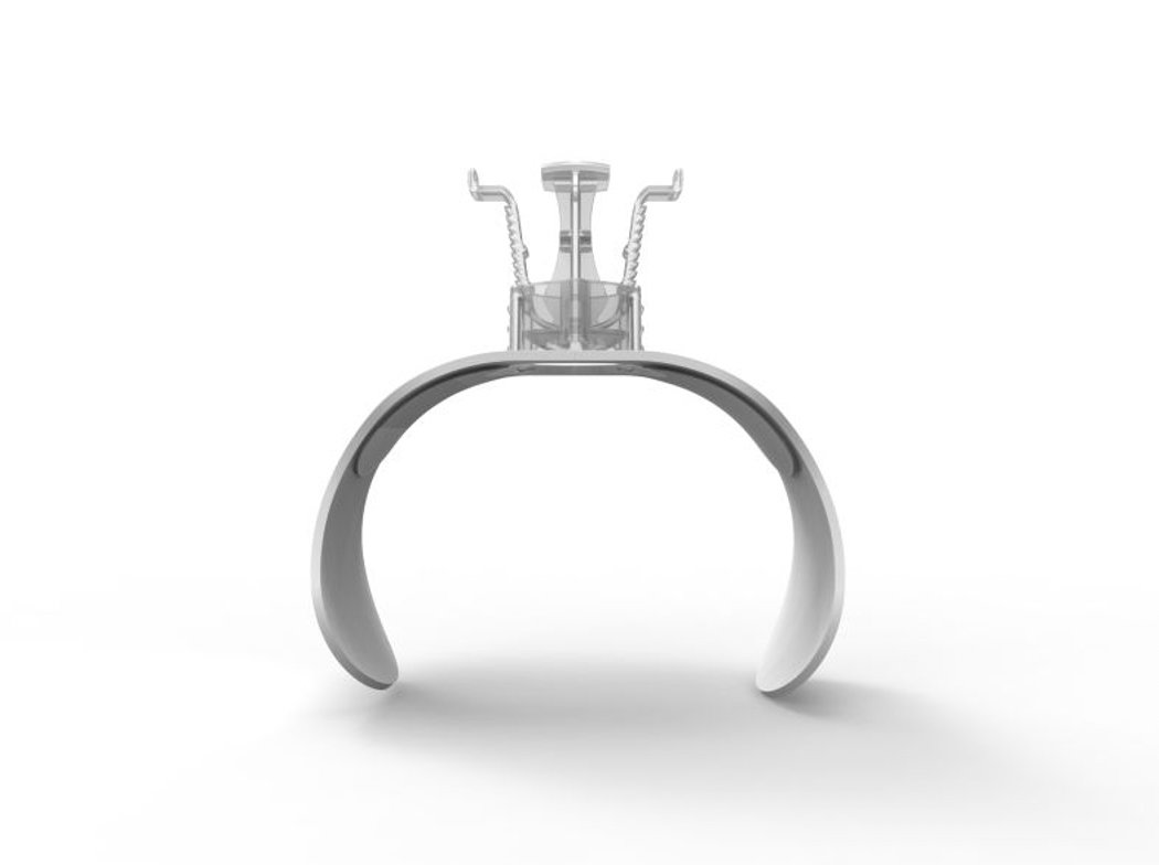 ForgeMedical's tweet photo. The #VasoStat plunger’s convex design mimics manual compression (similar to the shape of your thumb). This is how it achieves #hemostasis quicker than balloon bands. #focusedpressure #focusedcompression #radialfirst #pedalfirst https://t.co/VzyRexQUde