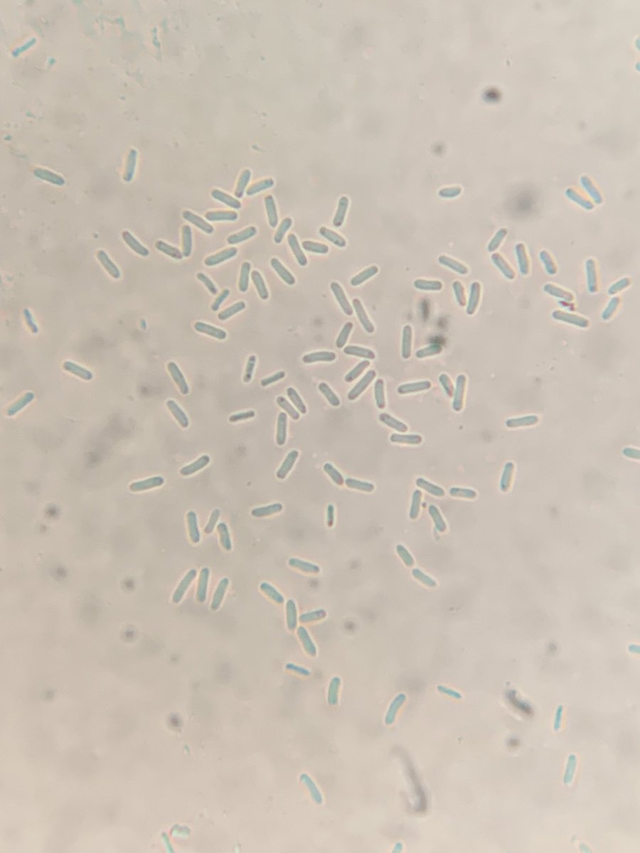 @wheatpath @RPilze @striiformis any ideas for this one please? On Ruscus aculeatus in SW England yesterday. Conidia (that I measured) 3.25-6.26μm - possibly the conidial state of Paraphaeosphaeria rusci?