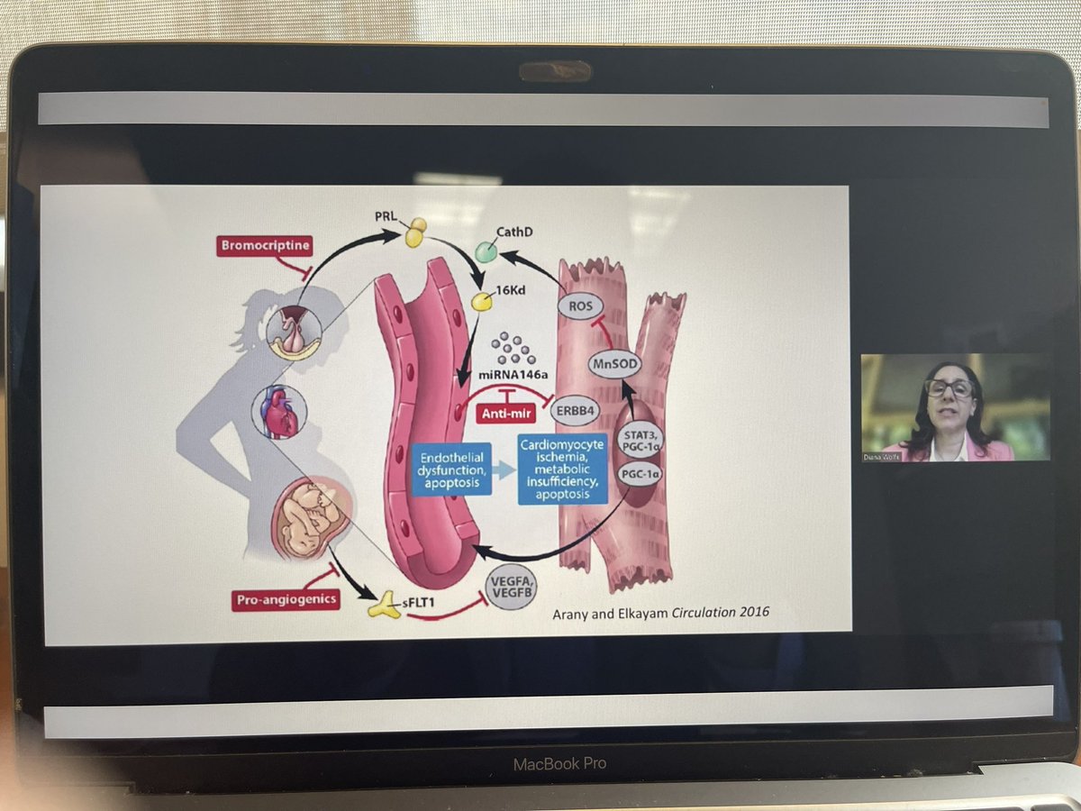 AmirShamshirsaz's tweet photo. Thanks to @dianaswolfe for the amazing review on “Postpartum Cardiac Disease and MCA” @CardioOb @MySMFM @JVaughtMD @AfshanHameedMD @ElizaMillerMD #obls #cardioobsteteics https://t.co/1DQzElXRCX