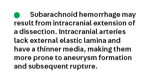 Bonus Key Point 3 from the article Cervical Artery Dissection by Dr. Setareh Salehi Omran (@SetarehOmranMD), which is available to subscribers at continpub.com/CervArtDis #neurology #MedEd #NeuroTwitter