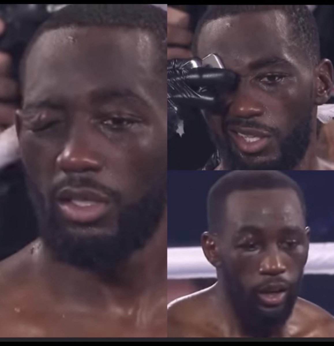 RayJack97010720's tweet photo. Kell Brook did this in 4 rounds to Crawfish eye wtf y'all think Spence gon do to lil buddy. Spence in 10 #SpenceCrawford https://t.co/iHDTk88KeG