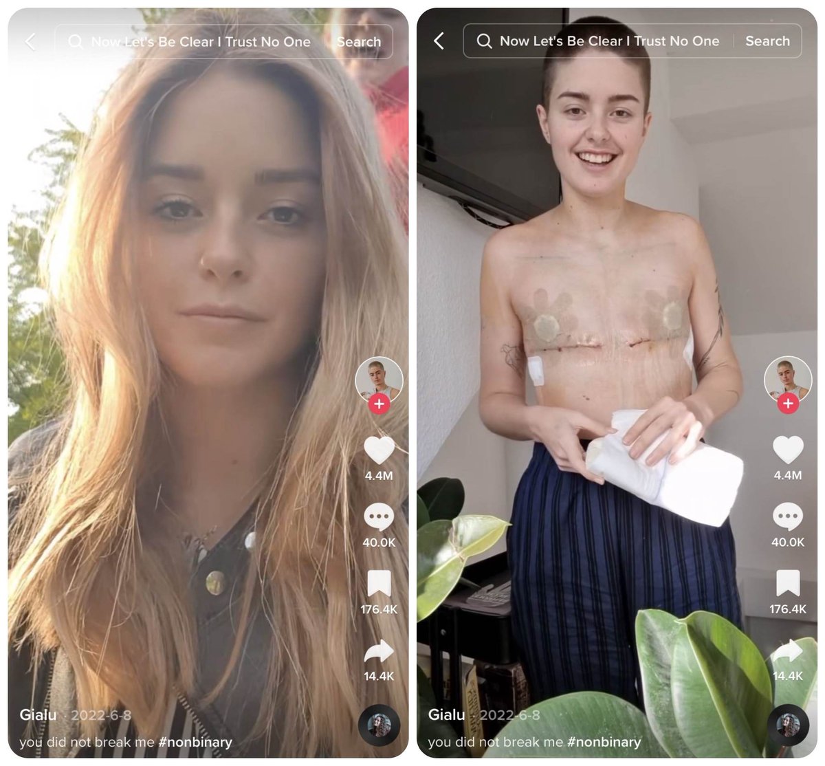 UnblendX's tweet image. What is a woman? 
What is a man?  

Well, removing body parts or adding body parts does not transform you into the opposite sex.   

Your body will still function with its innate characteristics  

Your gender is in your DNA!   

#whatisawomen #reece #capetown #JamieFoxx News 24