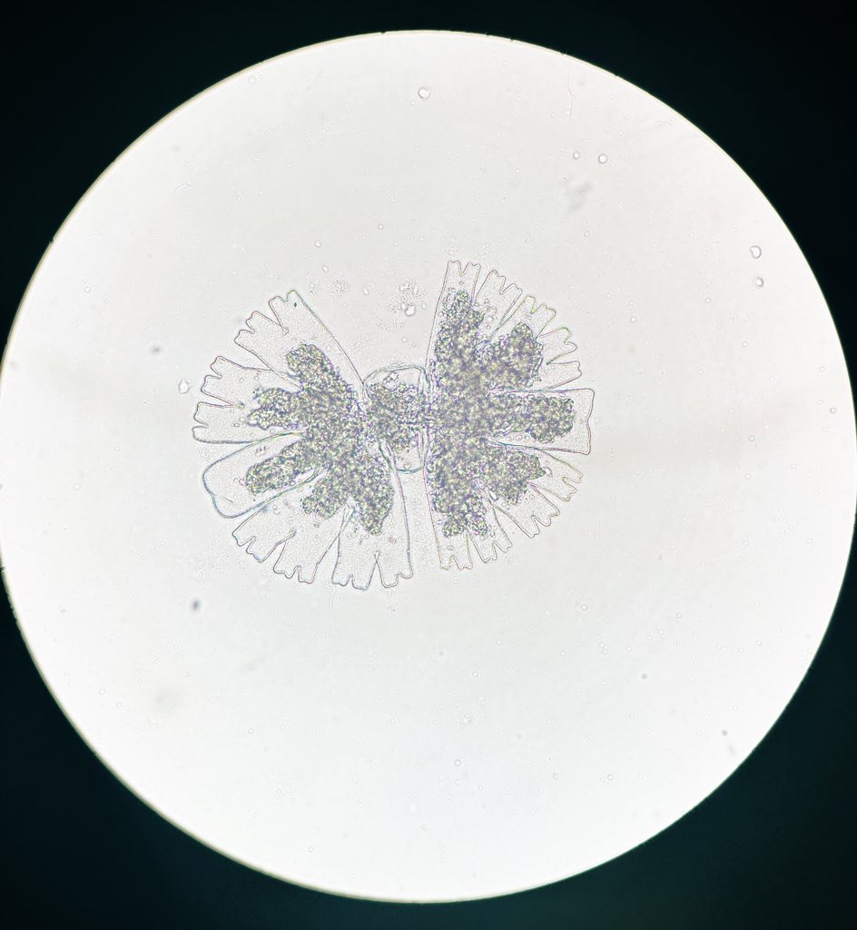 cbellissimo_'s tweet photo. And another division, this time a thomasian Micrasterias. 🤔
happy #phycologyfriday
#phycology #desmids #Microalgae https://t.co/8lnrRhHJOV
