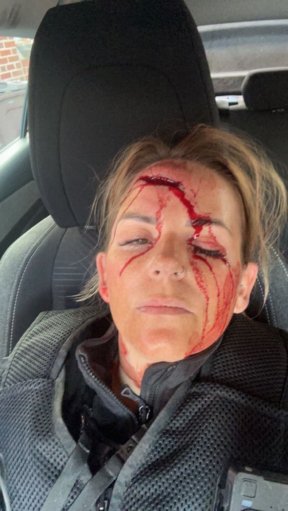 More than just a job! <a href="/WYP_WD_Impact/">WYP Wakefield Impact Team</a> 
officer PC Woods is recovering after being  injured apprehending a suspected drug dealer  in Wakefield. Suspect arrested for wounding, resisting arrest and dealing. Big respect, speedy recovery PC Woods.