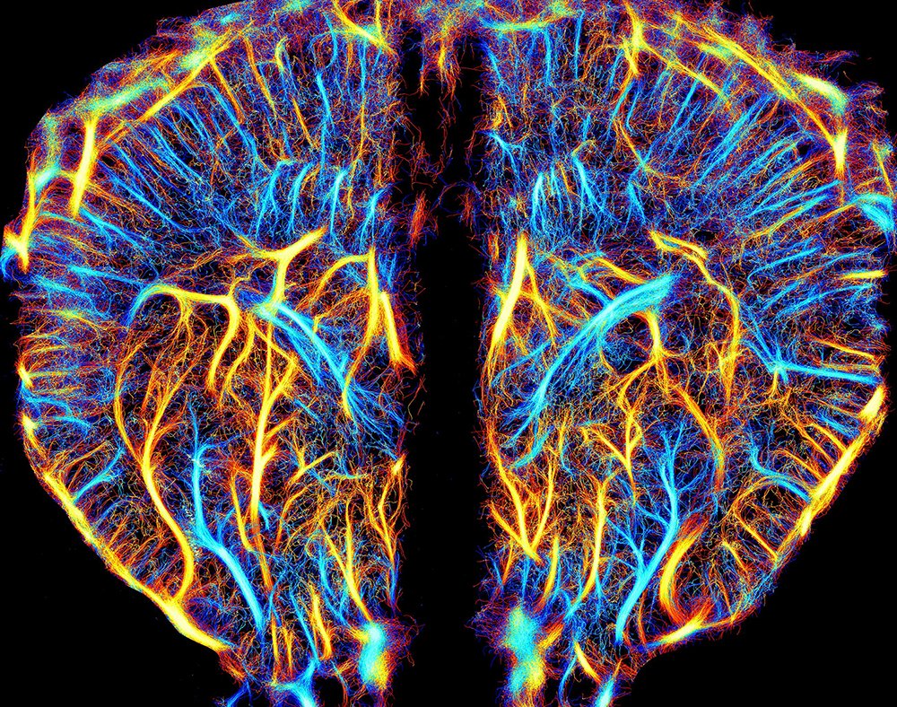 ProvostLab's tweet photo. 📢 Alexis Leconte, étudiant à la maîtrise au @ProvostLab @polymtl, est l'un des finalistes du concours de l'@_Acfas "La preuve par l'image" #LPPI ! Vous pouvez voter pour son image, "Les vaisseaux du souvenir", pour le Prix du public @DecouverteRC : https://t.co/CA7aYY4KIr https://t.co/6rUNpvCOgc