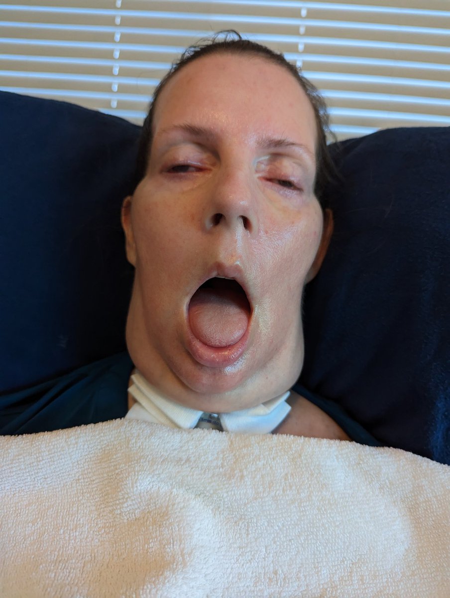 Ali Schoos, PT tweet media