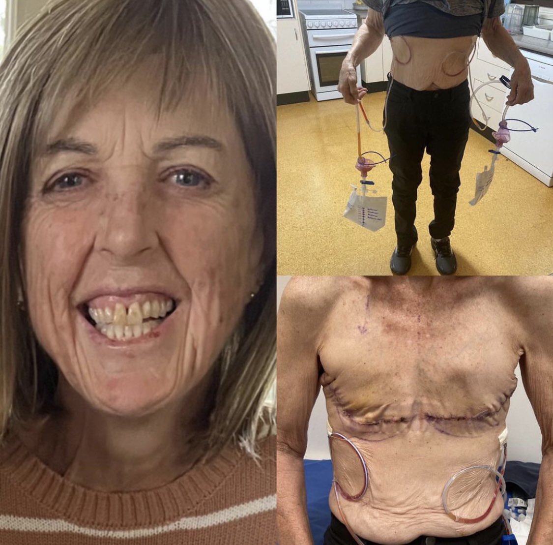 jabinjuriesglobal tweet media