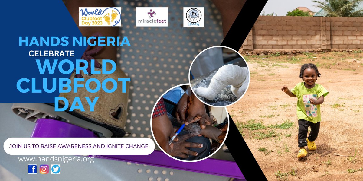 HANDS Nigeria joins the global movement on World Clubfoot Day to celebrate every step taken towards ensuring a world of inclusivity and opportunity for children with clubfoot. 
#ManyFeetMovement #WCD2023 #handsnigeria #MiracleFeet
#PonsetiMethod #ClubfootAwareness
#WCD #wcd2023