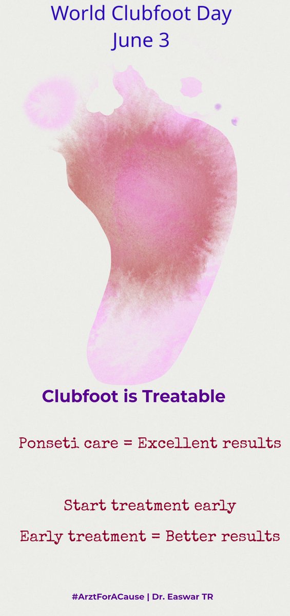 It's #worldclubfootday today. 

A day to remind, educate, advocate, teach and spread the news that #Clubfoot is treatable. 

1. Ponseti treatment is Gold standard 
2. Early treatment gives better results 
3. Continued care promises sustained results