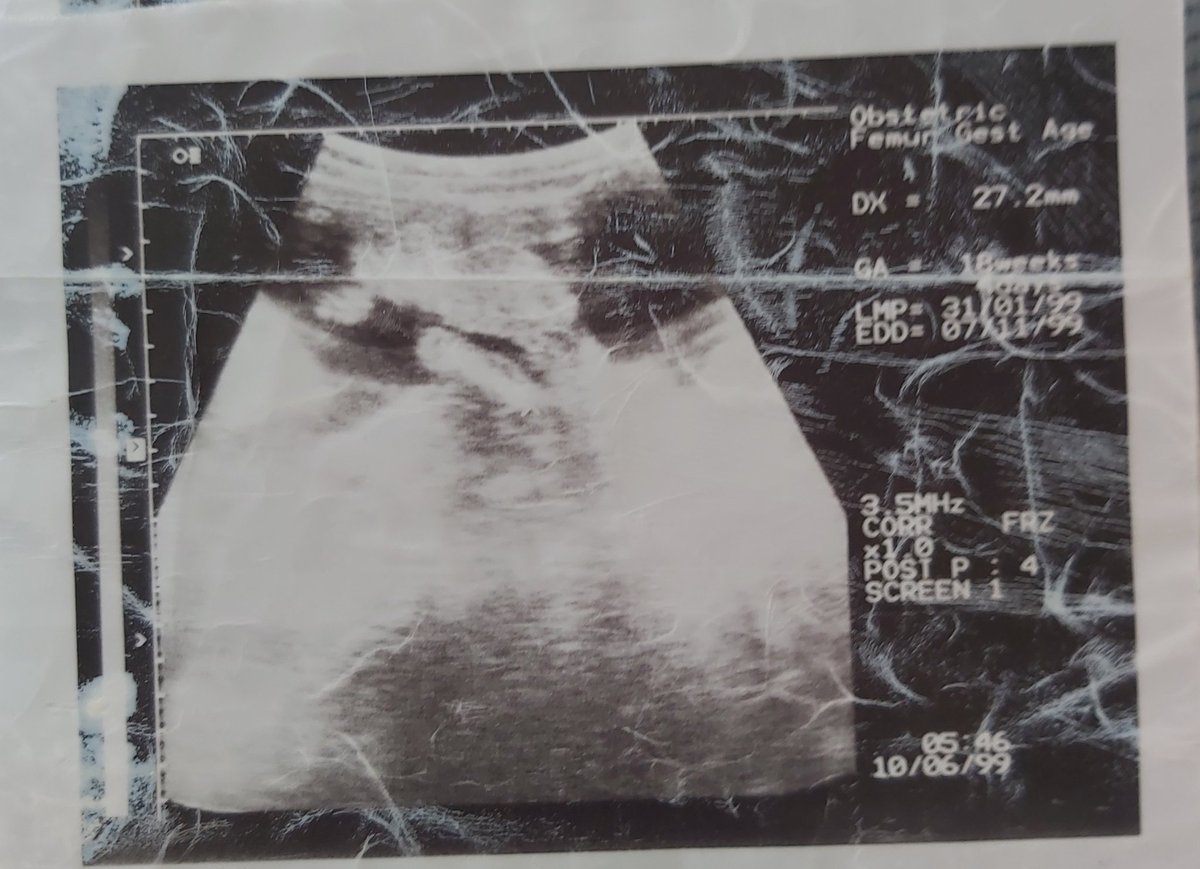 irem (@iremflea) on Twitter photo 