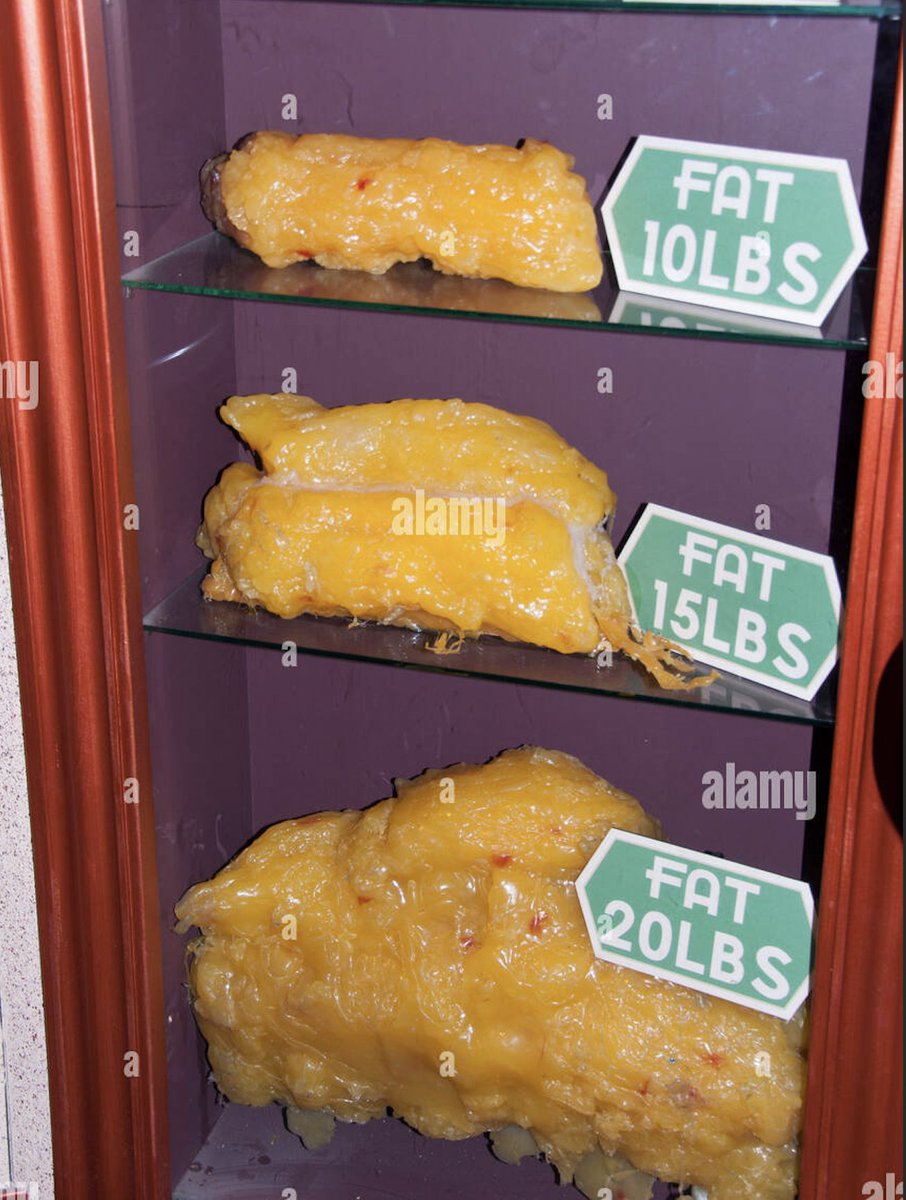 20lbs of fat loss may not sound like much..

But would you rather carry this around or get rid of it?

Use the 5 steps below to lose 20lbs in the next 60 days: